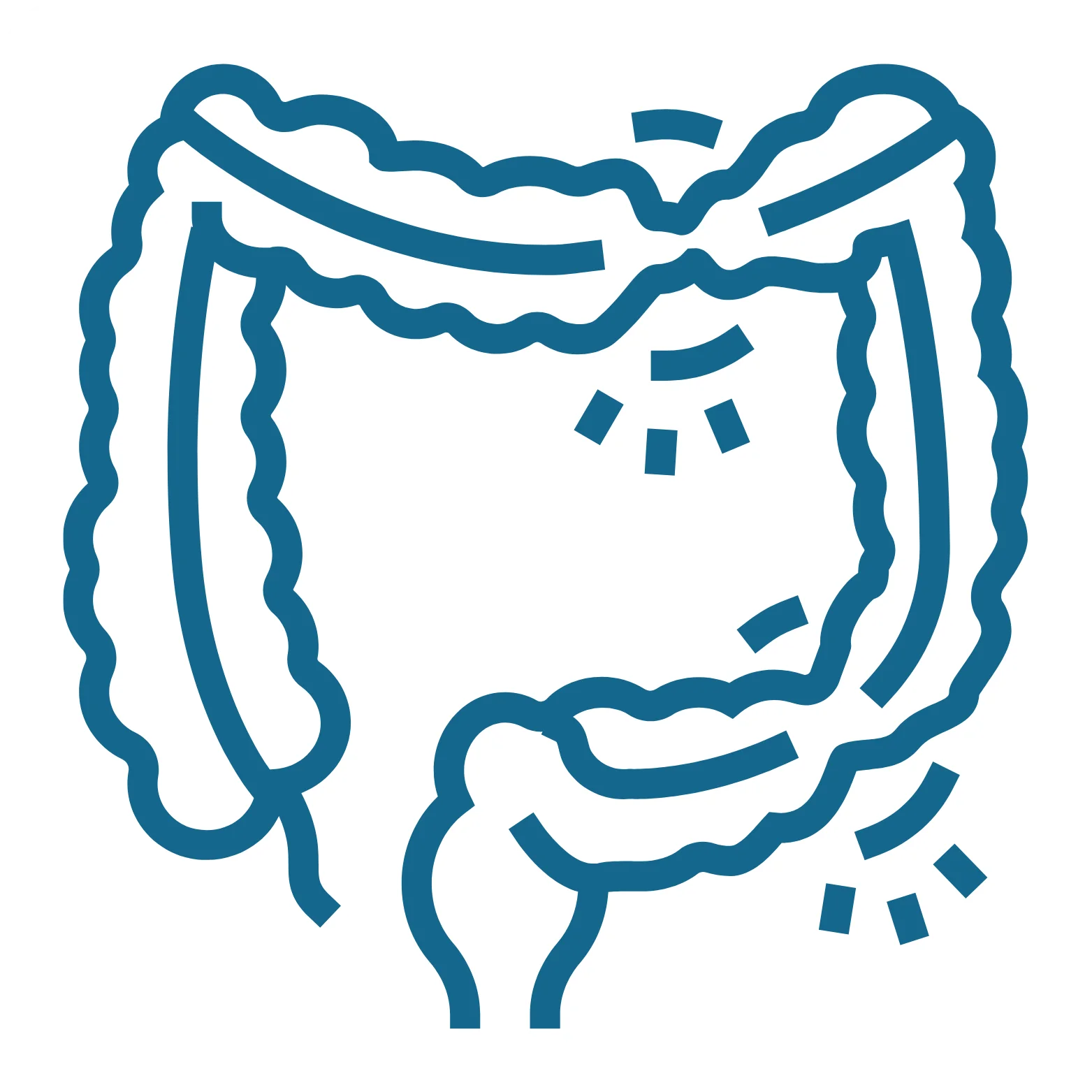 Irritable Bowel Syndrome (IBS)